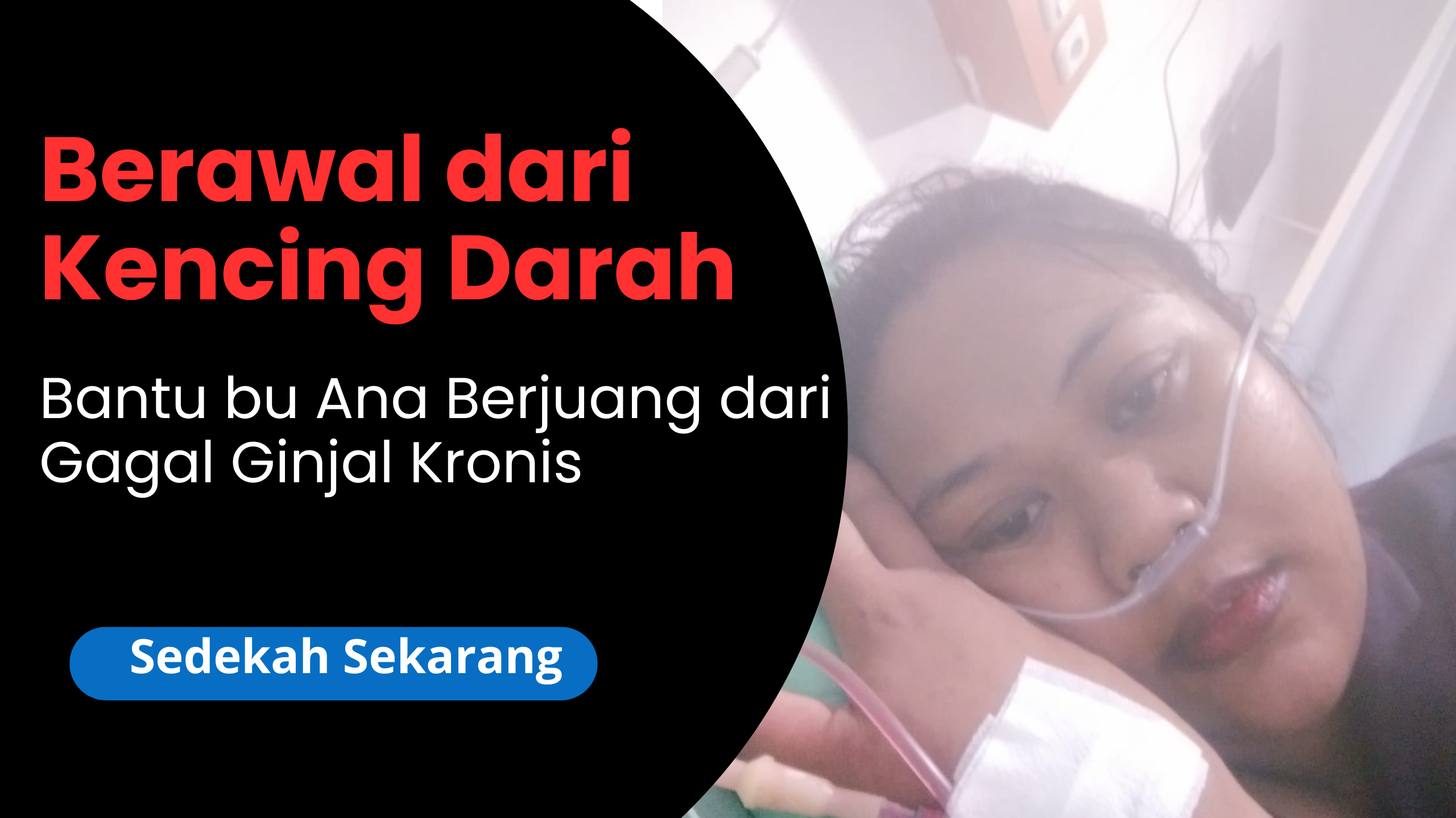Wajib Cuci Darah, Bantu Ana Berjuang Hidup!