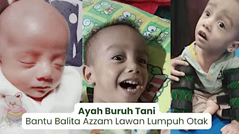 Ulurkan Tangan untuk Azzam Melawan Cerebral Palsy